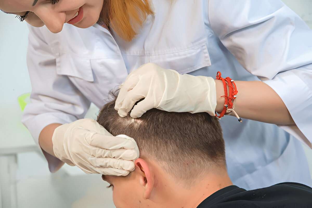 hair transplant UK