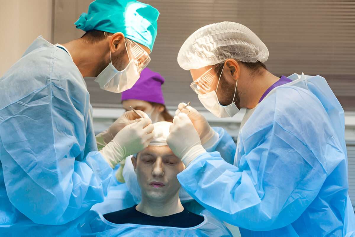 hair transplant