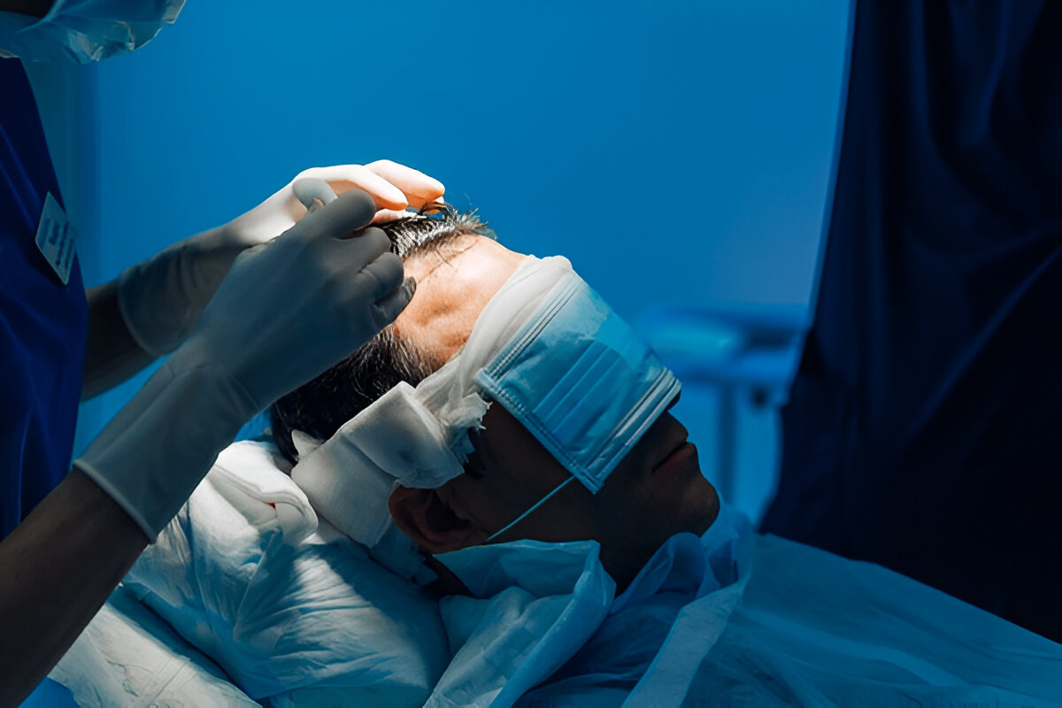 best hair transplant UK
